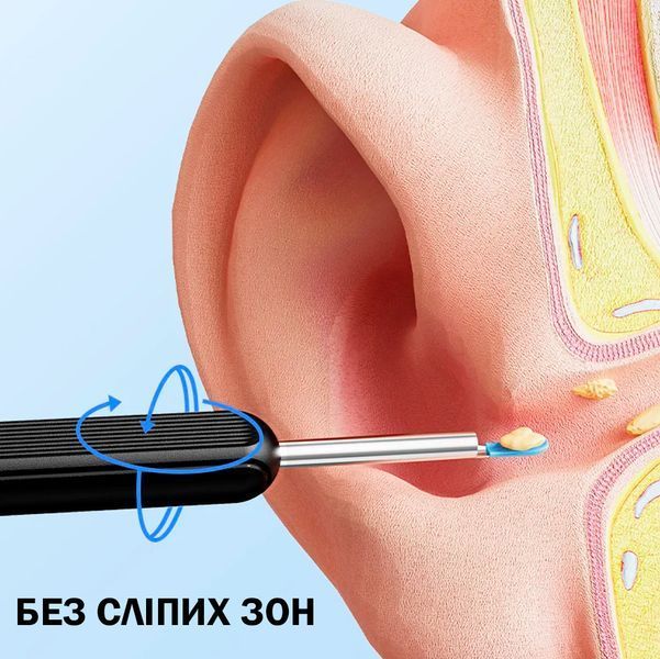 Універсальна Розумна вушна паличка WIFI з насадками B6/ Прилад для чищення вух, видалення вушної сірки з камерою Чорний 116943 фото